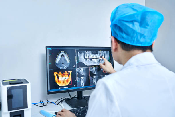 Best Emergency Treatment for Dental Infections or Abscesses in Silver Firs, WA